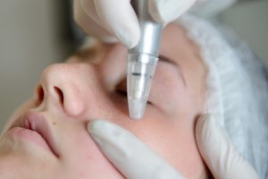 Microdermabrasion