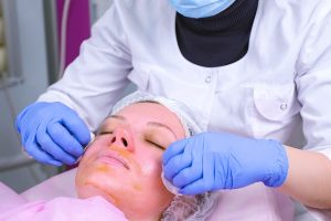 Chemical Peel