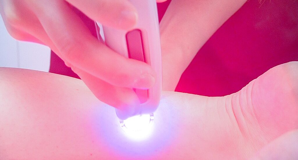 What Not To Do After Laser Hair Removal